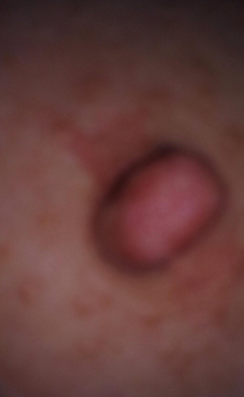 4P Nipple before and after