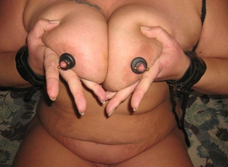 25P nipple pain