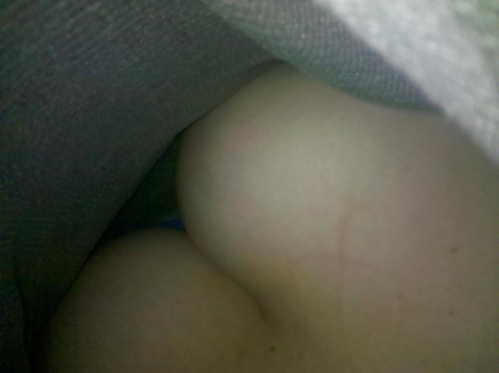 5P Cleavage 