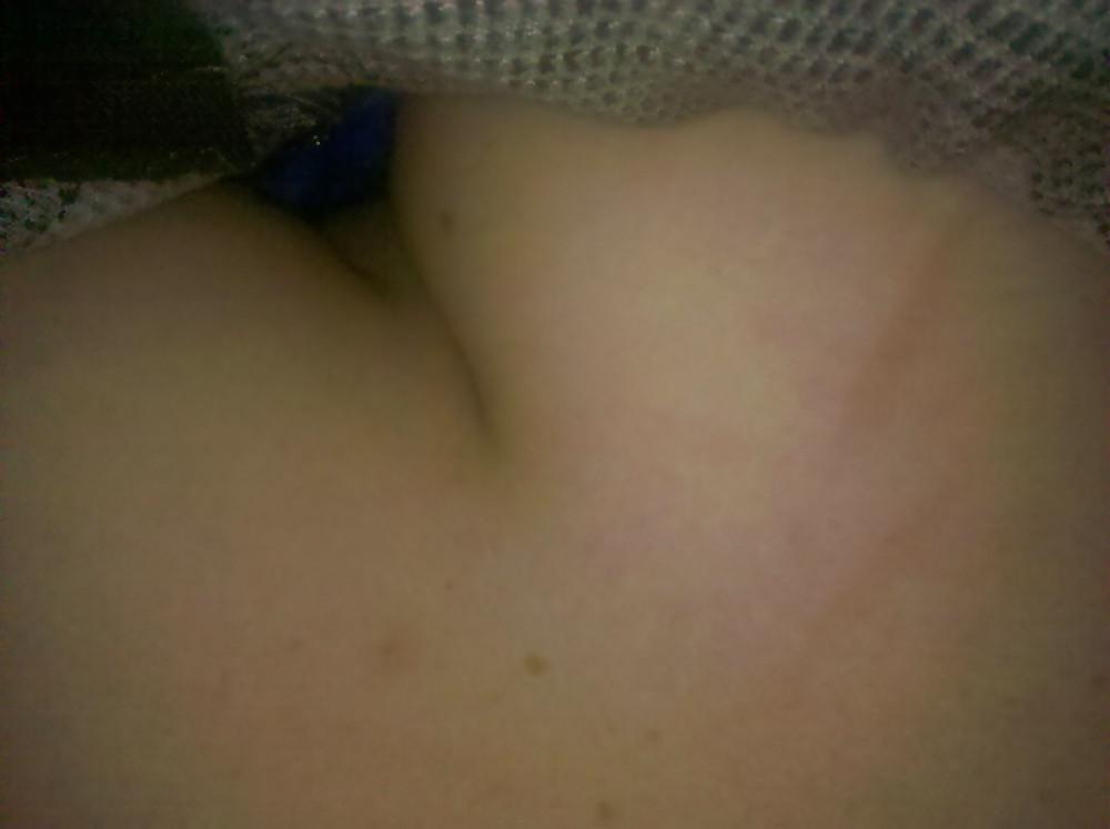 5P Cleavage 