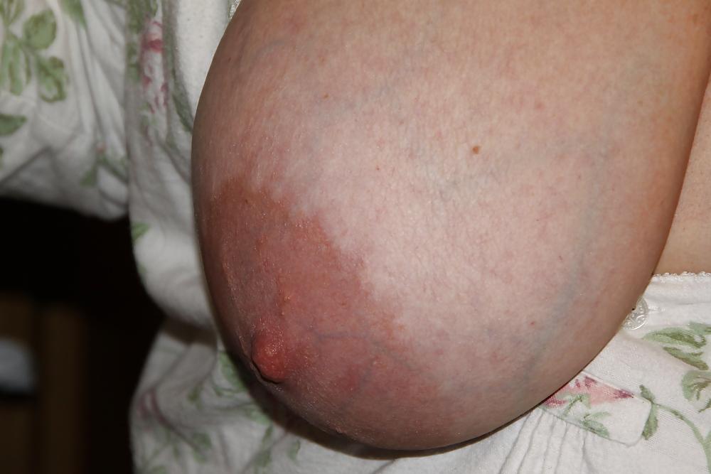 9P BBW mature