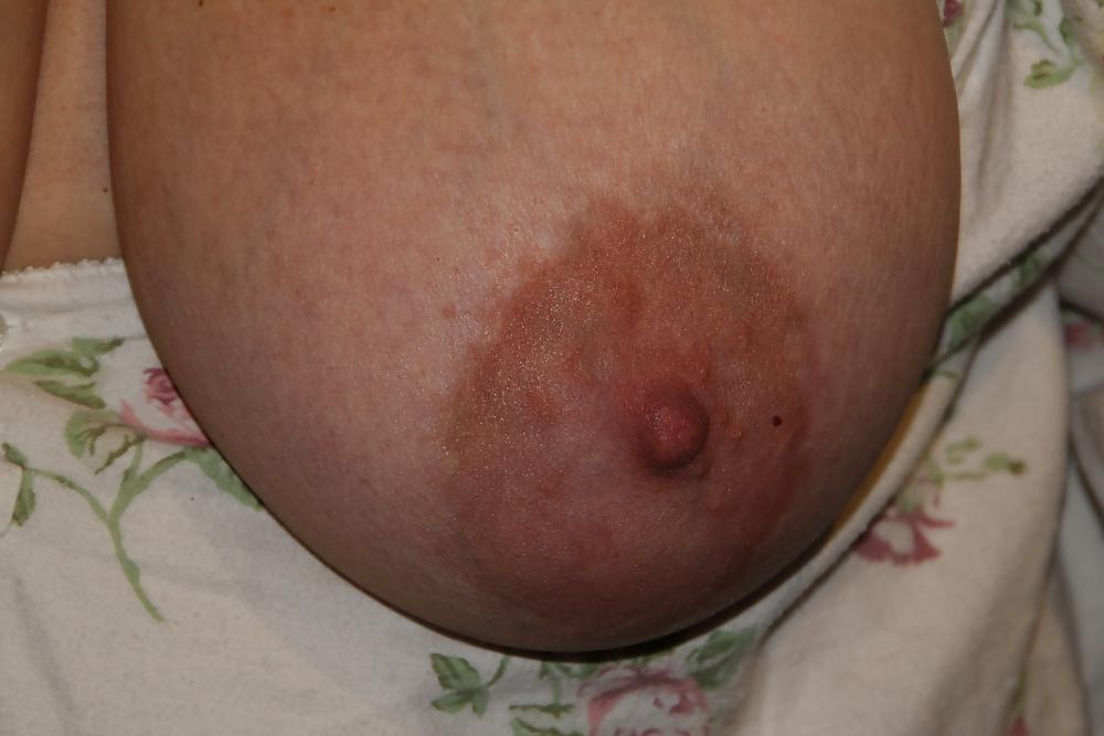 9P BBW mature