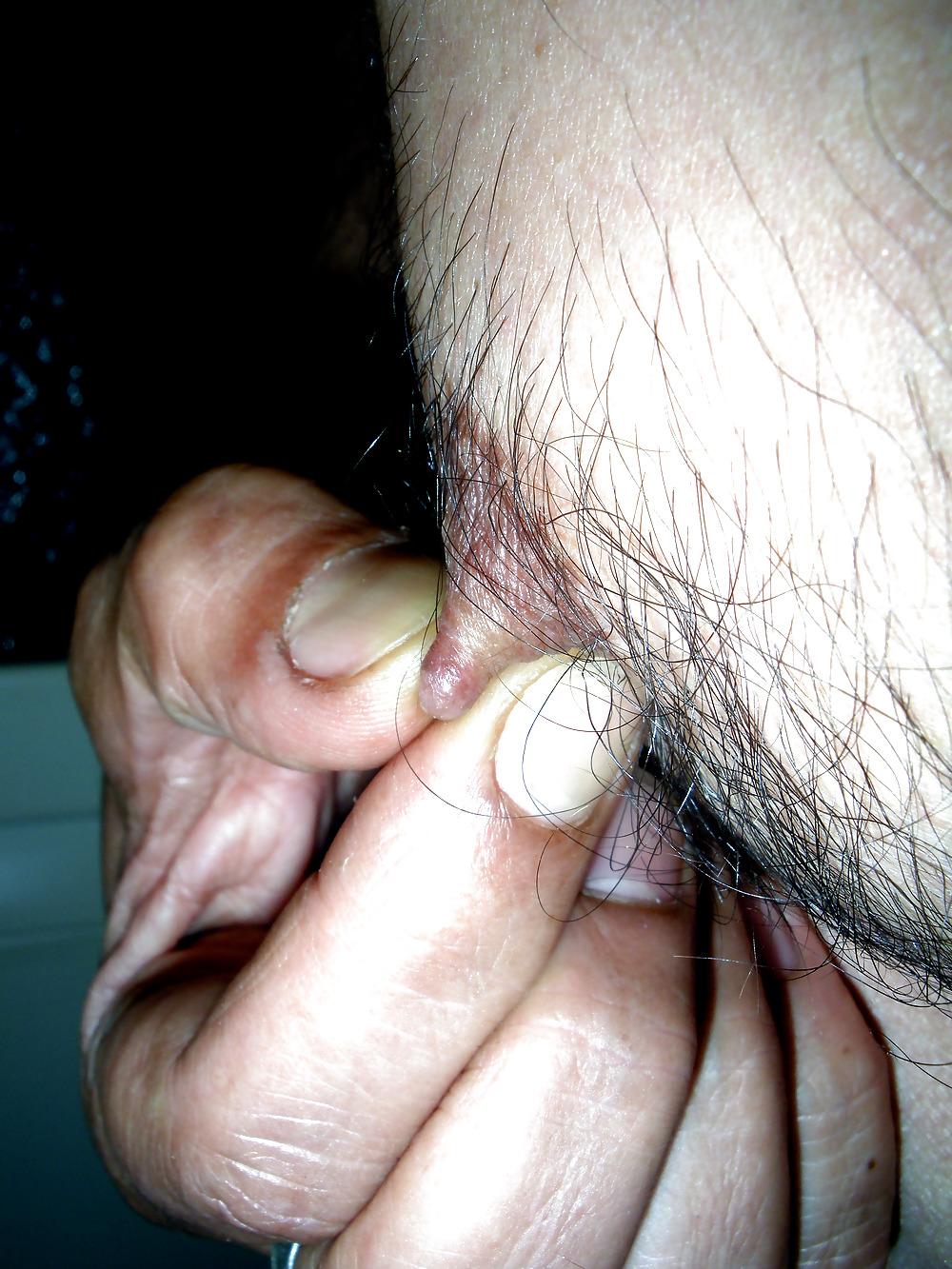 19P Nipples (Men)
