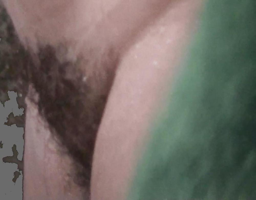 6P Near nipples