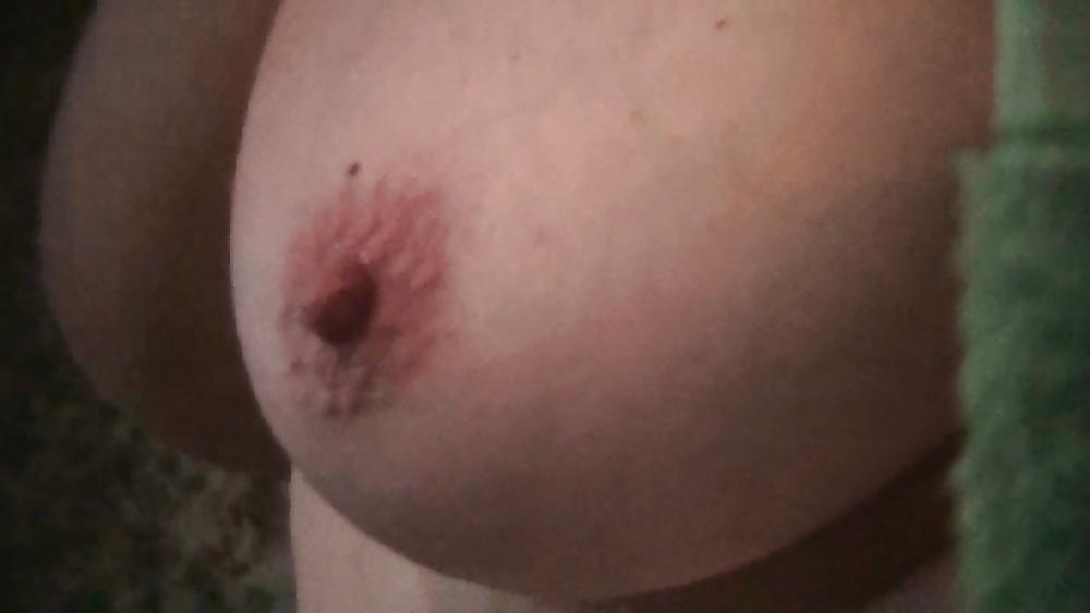 6P Near nipples