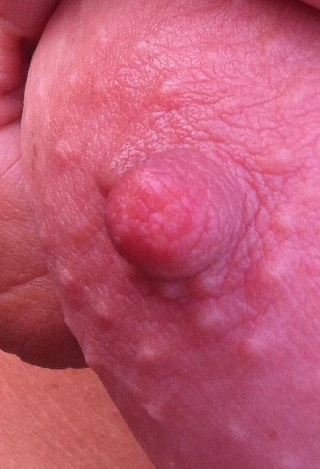 15P Nipples