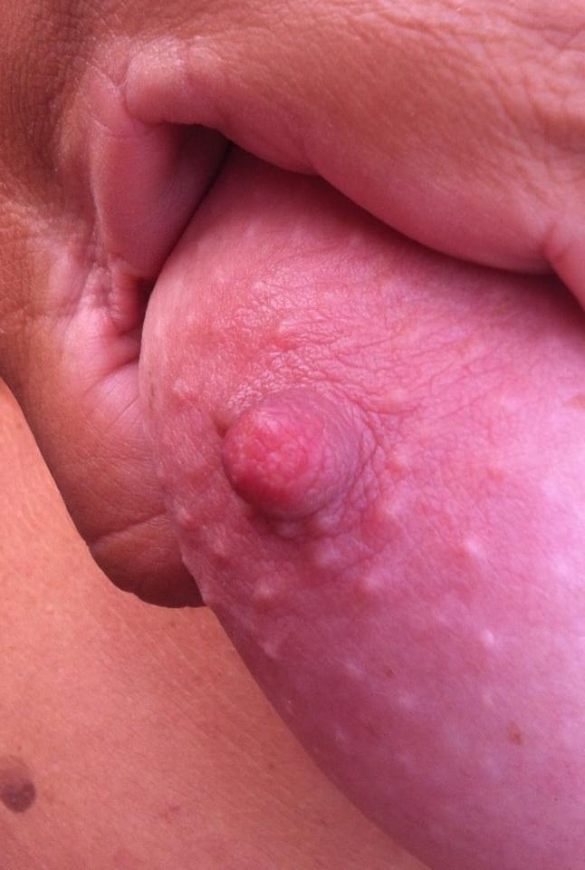 15P Nipples