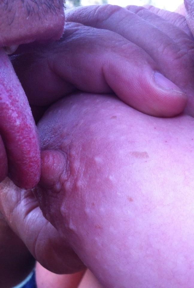 15P Nipples