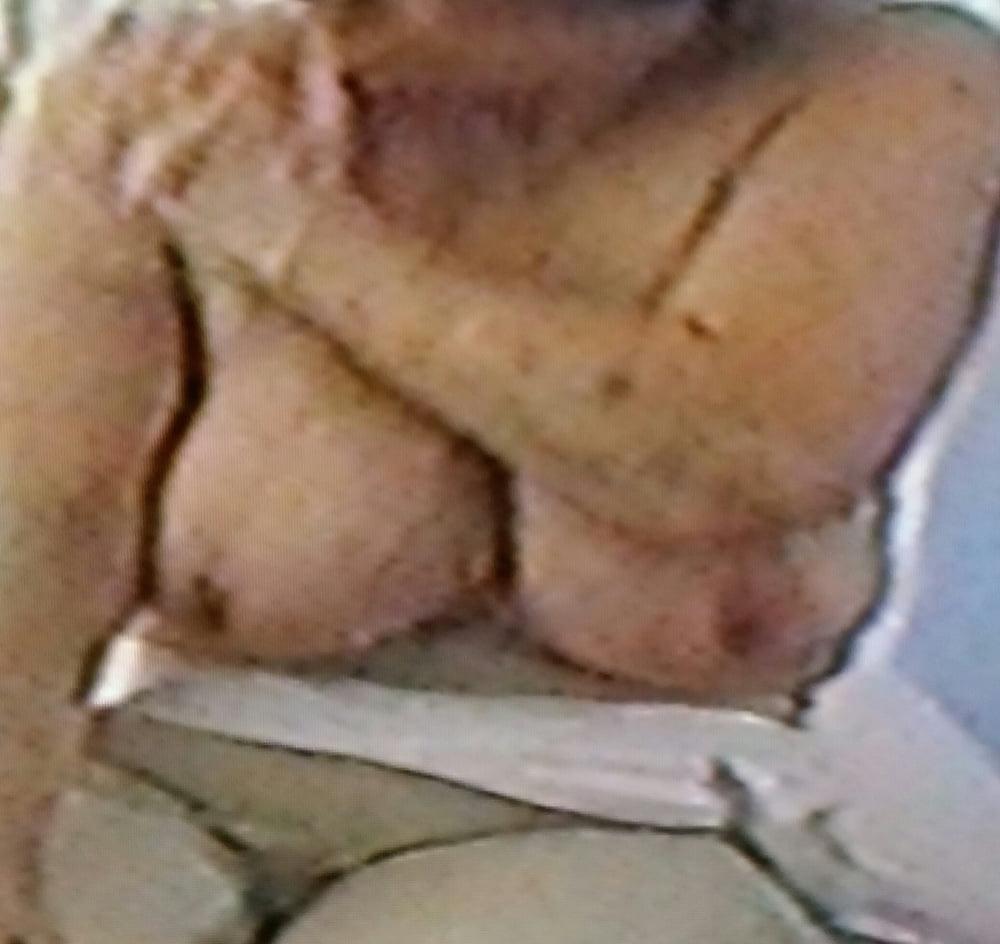 11P 83 y o granny