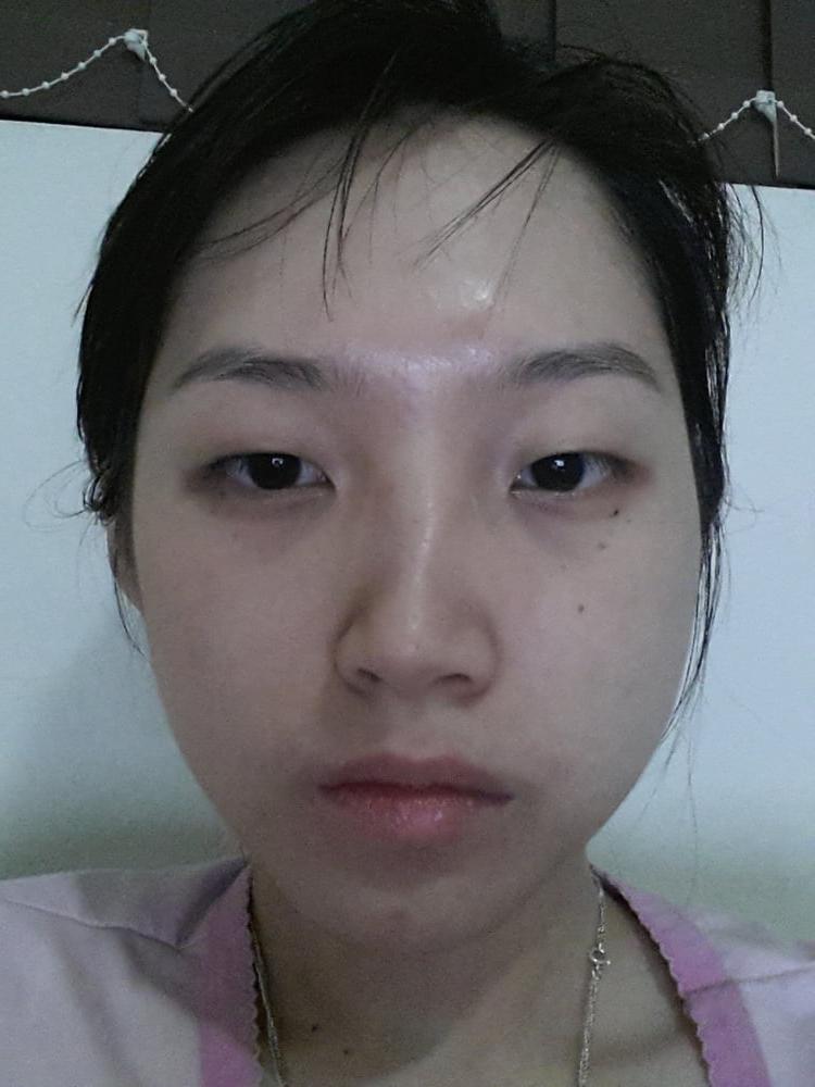 25P Vietnamese Amateur-2