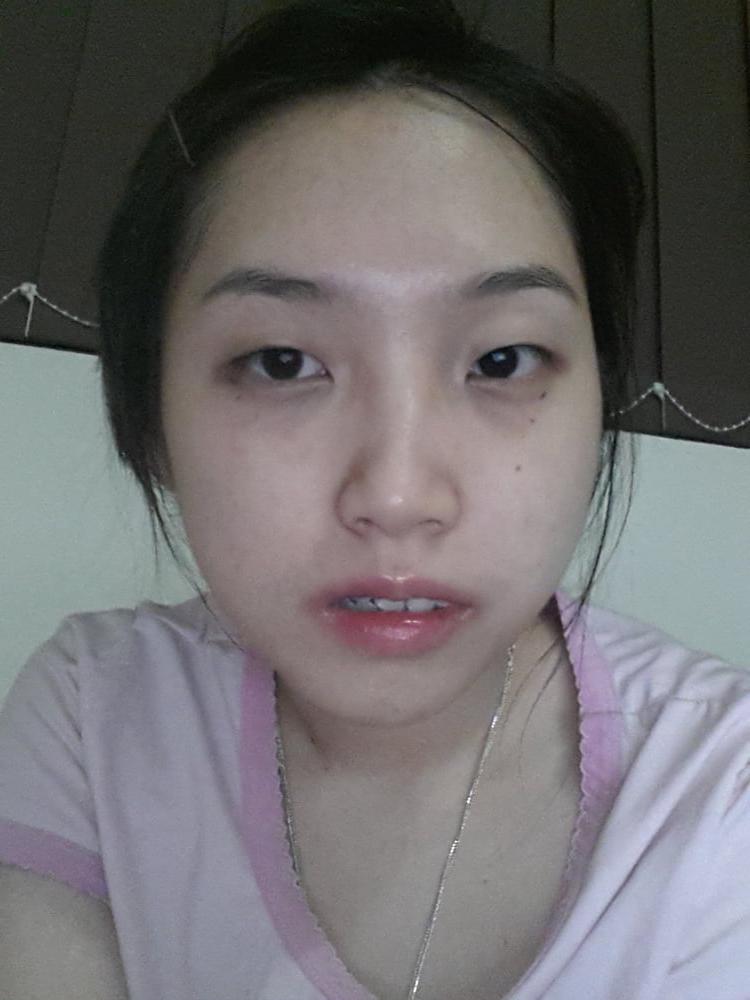 25P Vietnamese Amateur-2