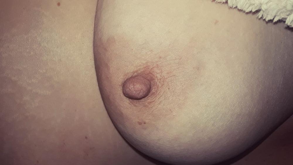 14P Nipples