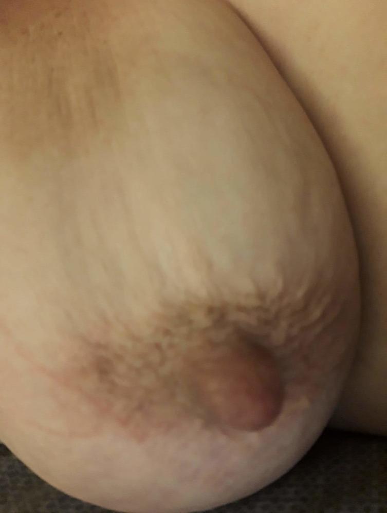 14P Nipples