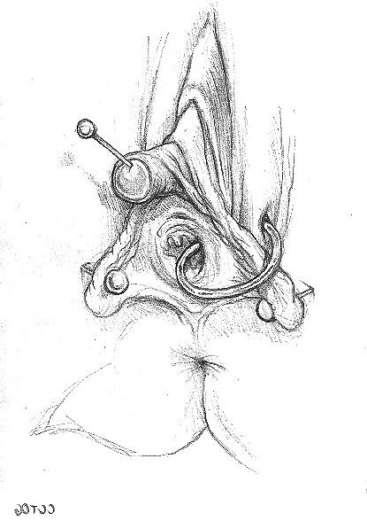 14P Some rough stuff