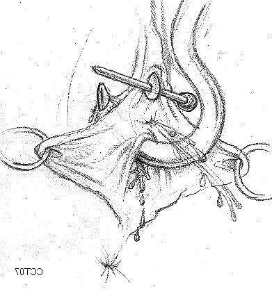 14P Some rough stuff
