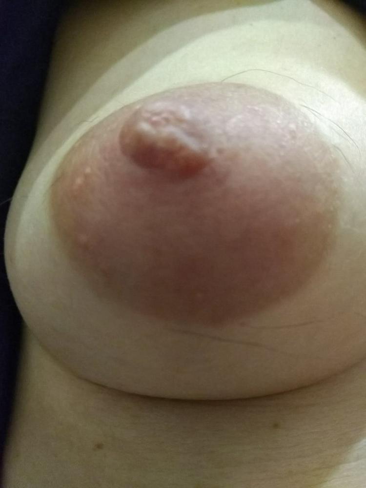 5P Hairy nipples 2