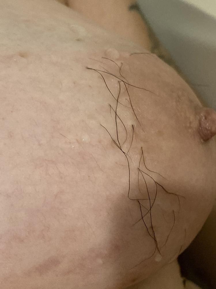 5P Hairy nipples 2