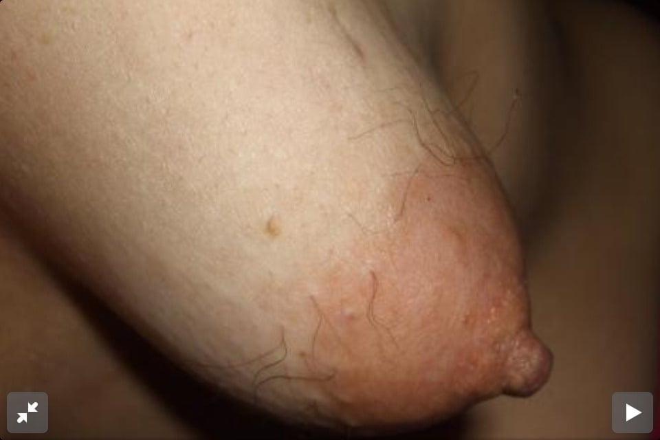 5P Hairy nipples 2