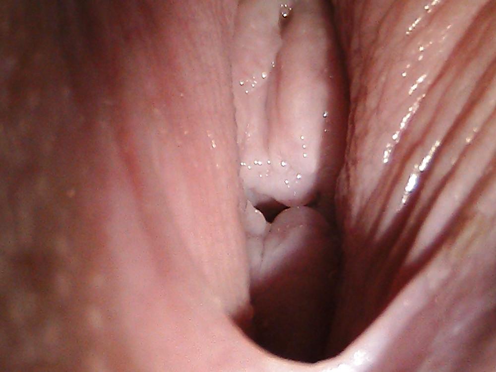 9P Close-up