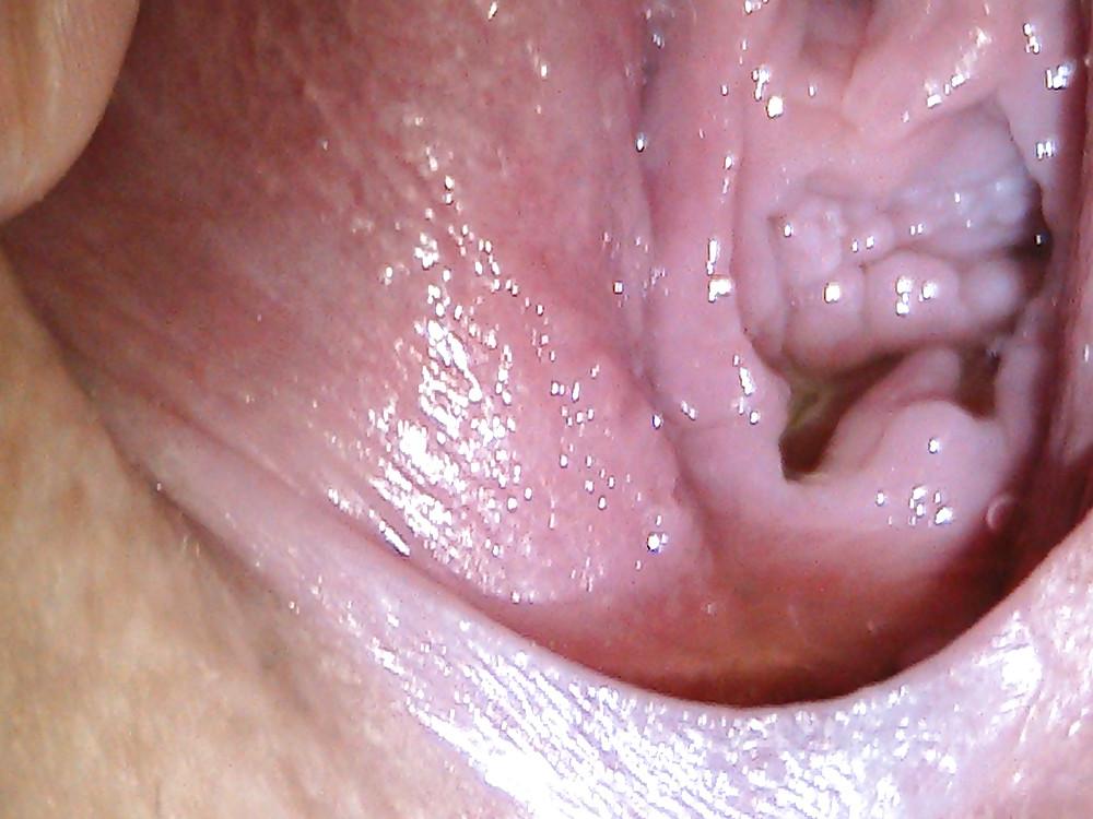 9P Close-up