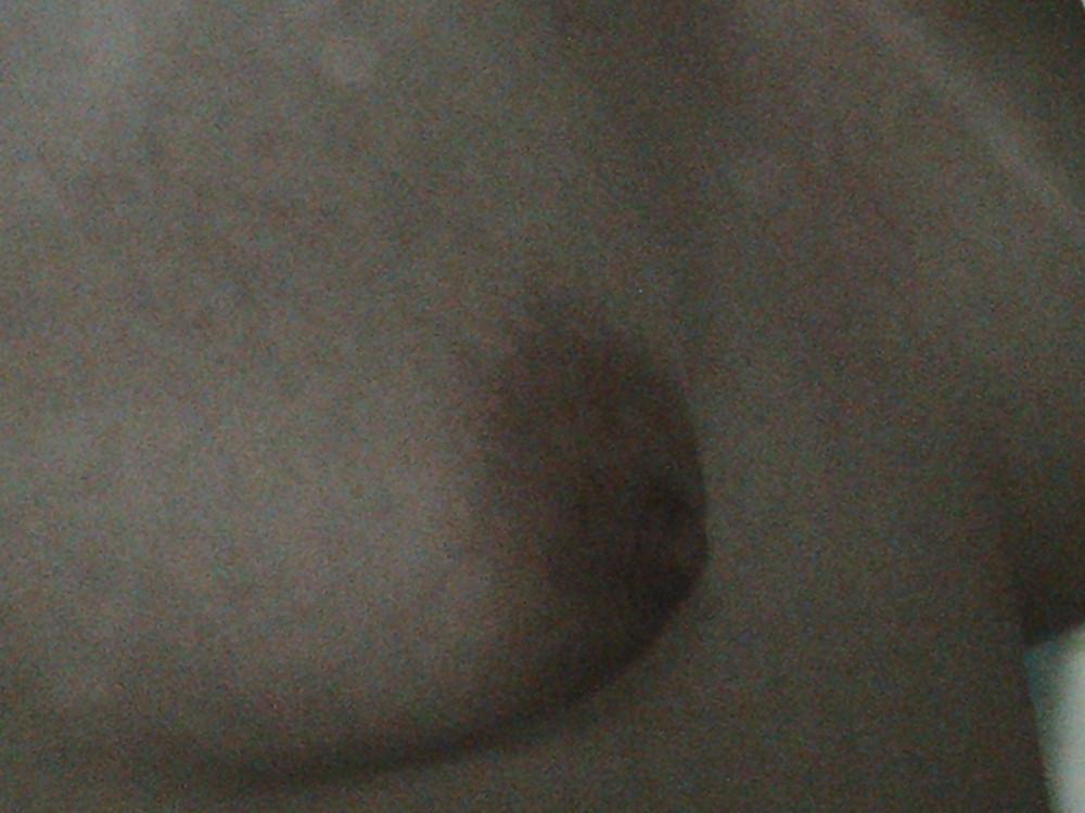9P Close-up