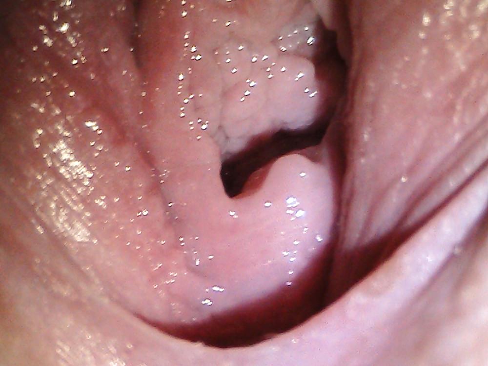 9P Close-up