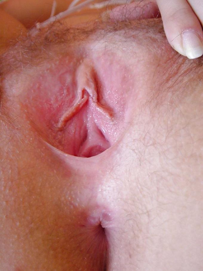 25P Close-up pussy pics