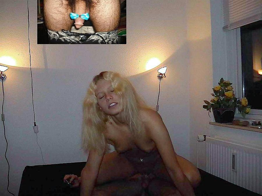 12P Eating hair