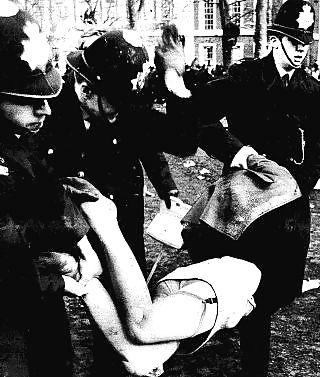 20P Stocking tops shown by accidents