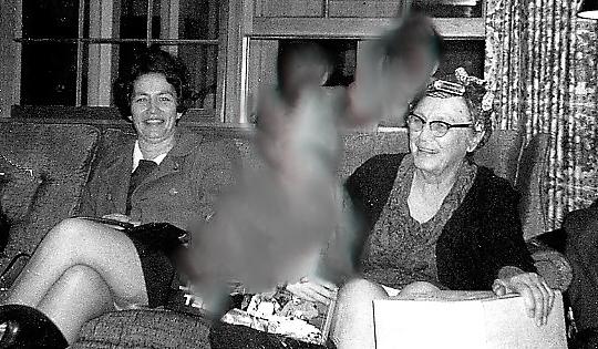 20P Stocking tops shown by accidents
