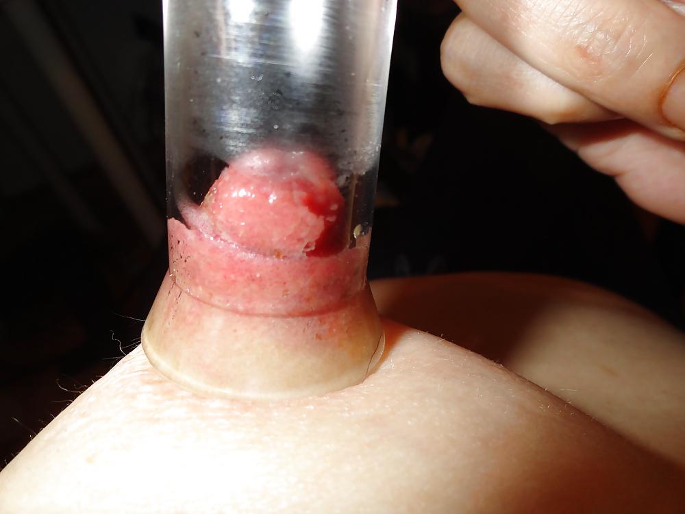8P Nipples
