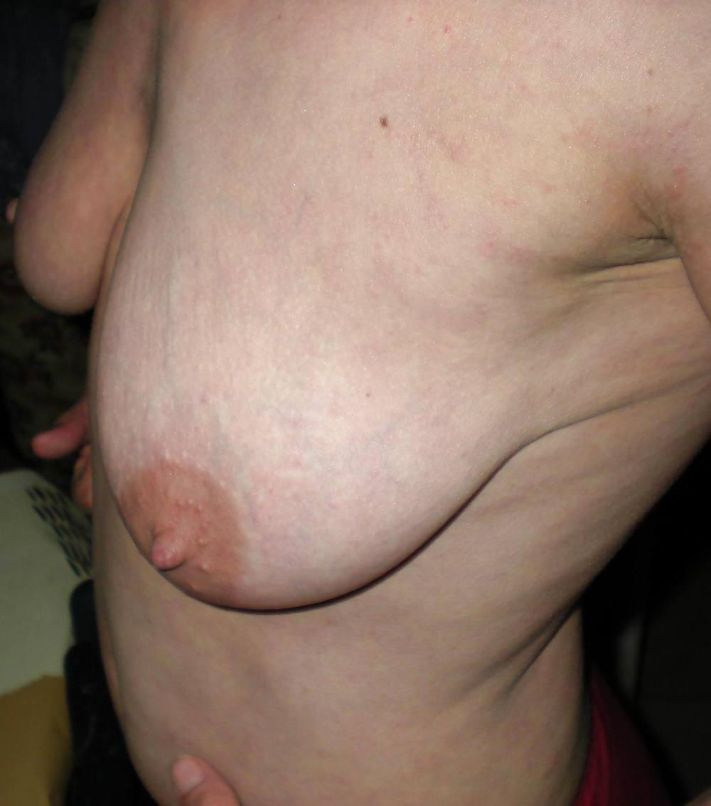 25P Seins    ( topless-Nipples )