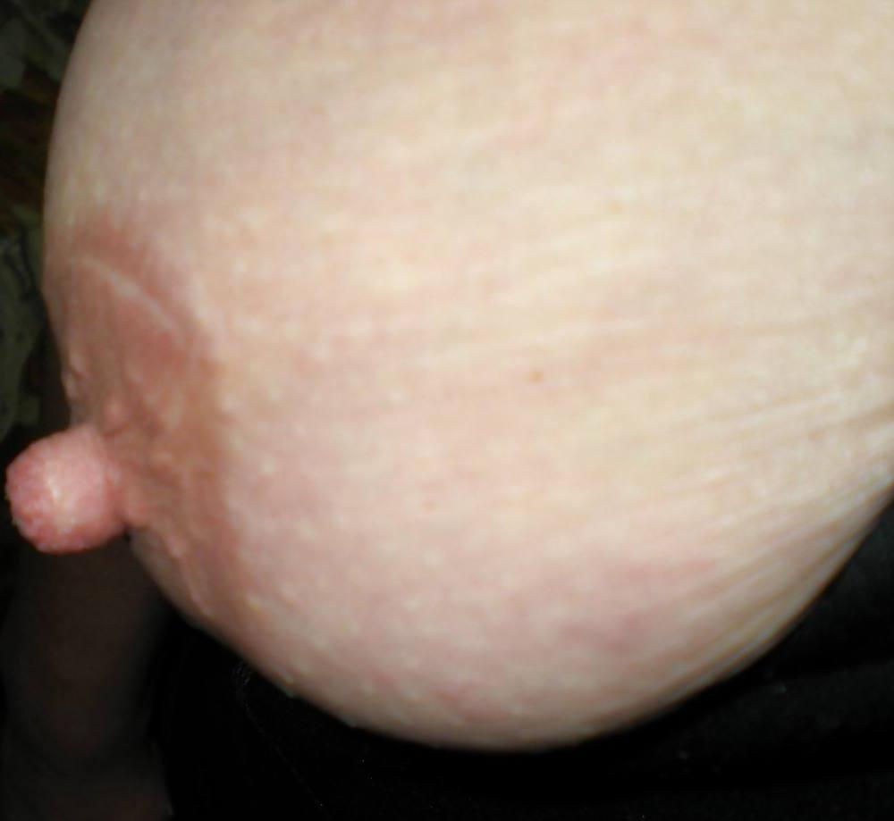 25P Seins    ( topless-Nipples )