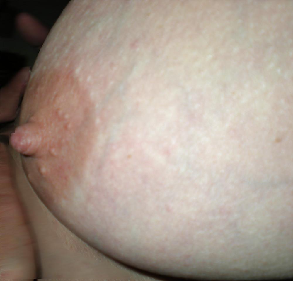 25P Seins    ( topless-Nipples )