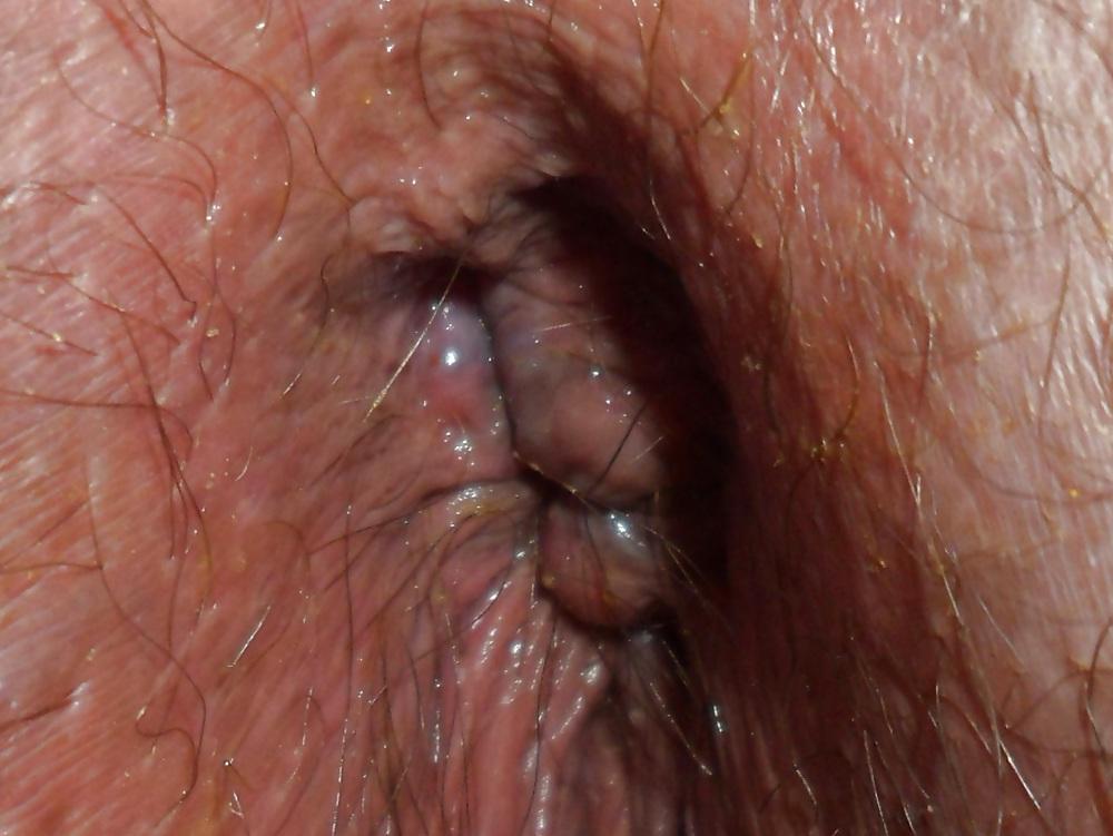 18P My Ass Close-up in HD