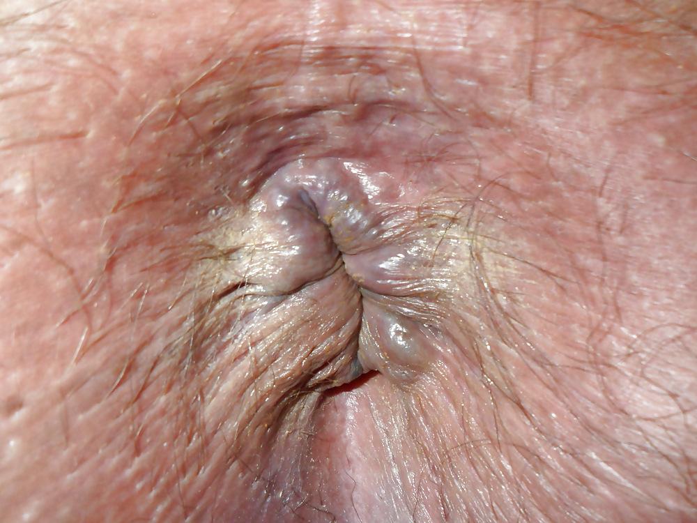 18P My Ass Close-up in HD
