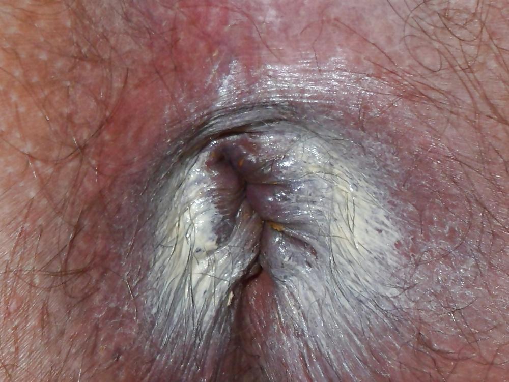 18P My Ass Close-up in HD