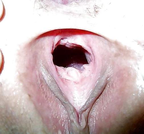 25P Pussy Pictures