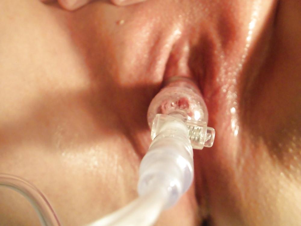 25P Clit Pumping