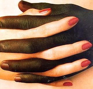 19P Interracial marriage