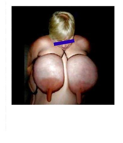 15P If only giant areolas