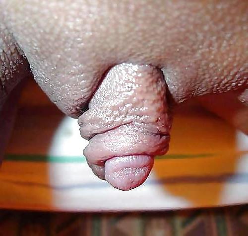 25P Clits Nips & Lips