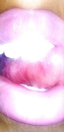 25P Clits Nips & Lips