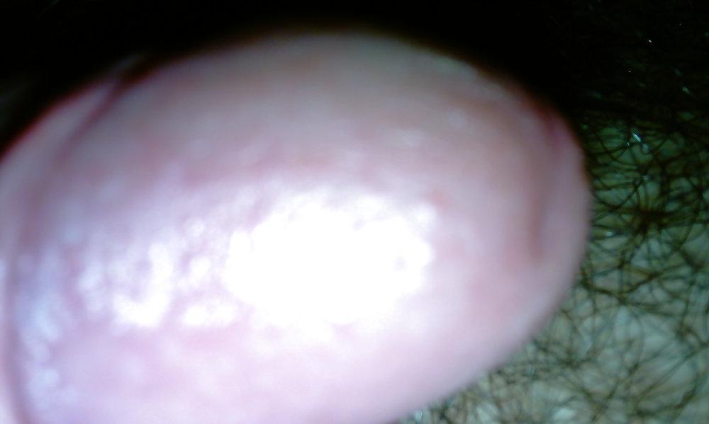 25P Cock head close up