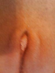 10P My clit in orgasm