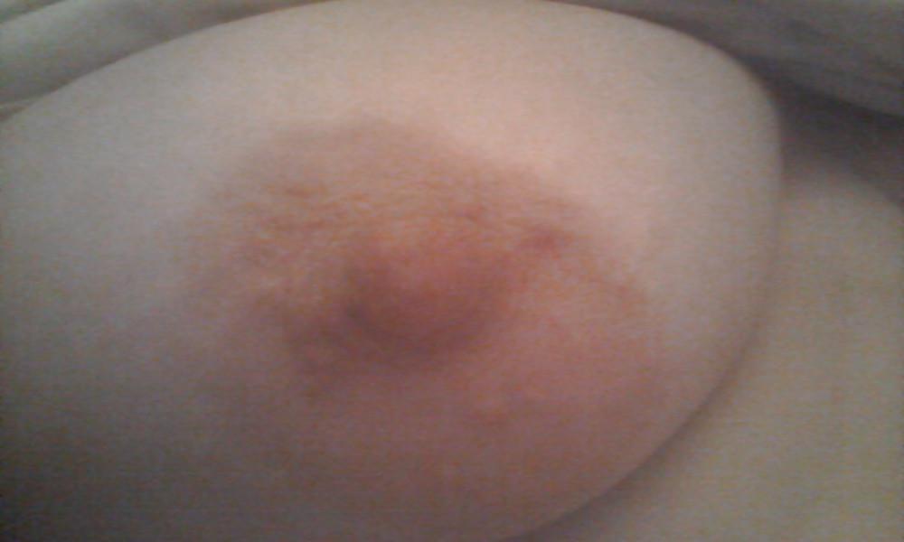 9P Nipples
