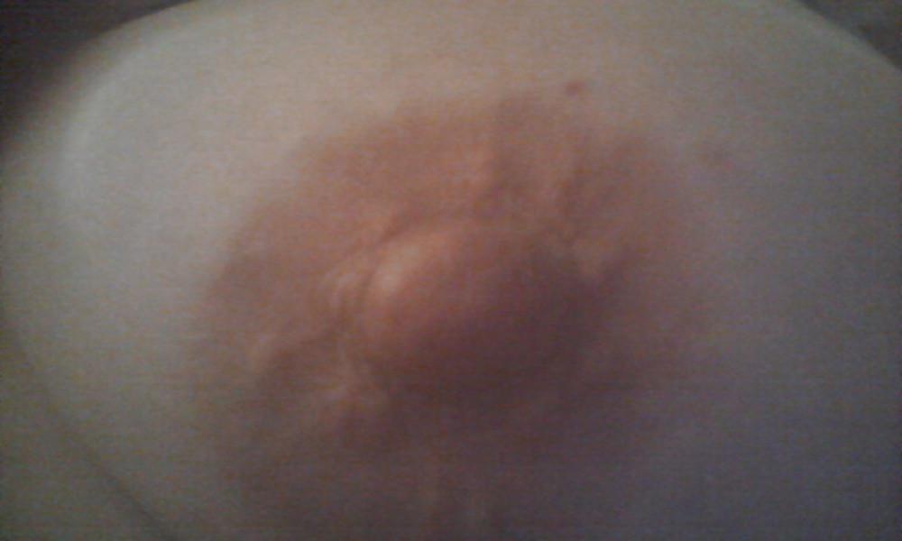 9P Nipples