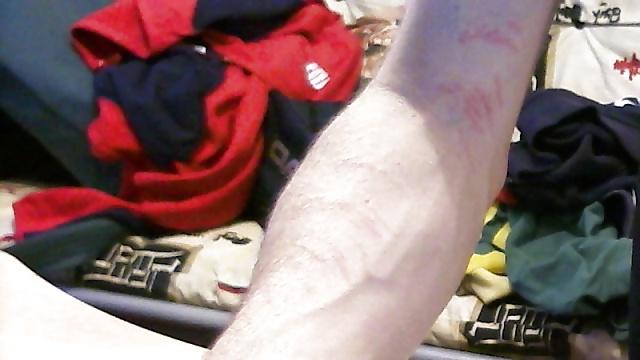 4P My Vampire Glove being used on me!!! The results