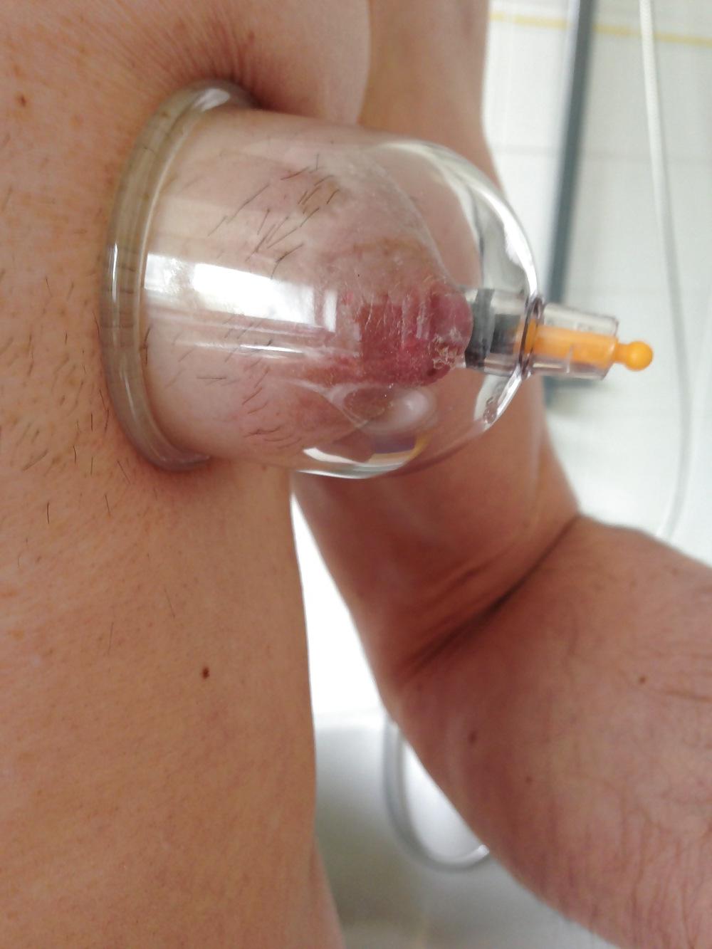 19P NIPPLES STRETCHING