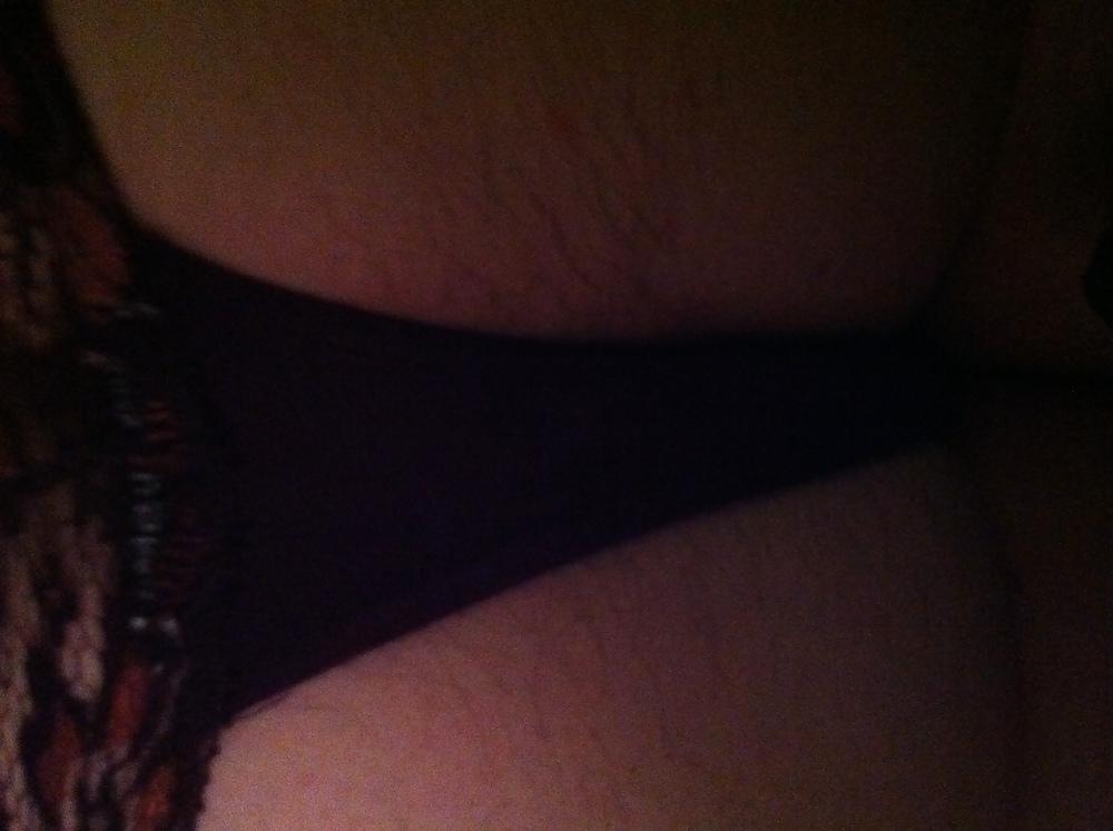 7P 18 y.o pre anal